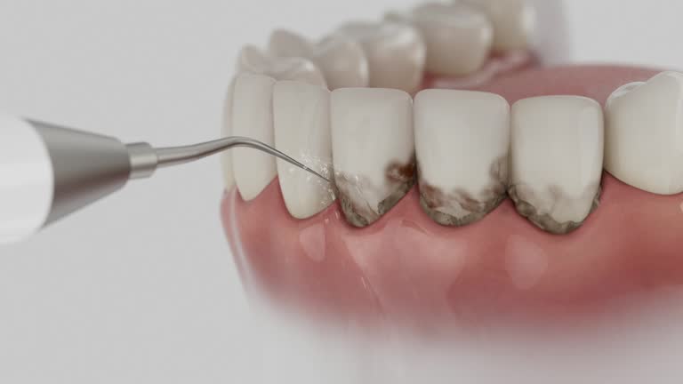 Reliable Dental Implants contractor in Enochville, NC by Smile Center Dentistry